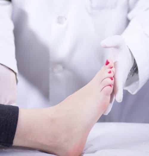 ingrown toenails