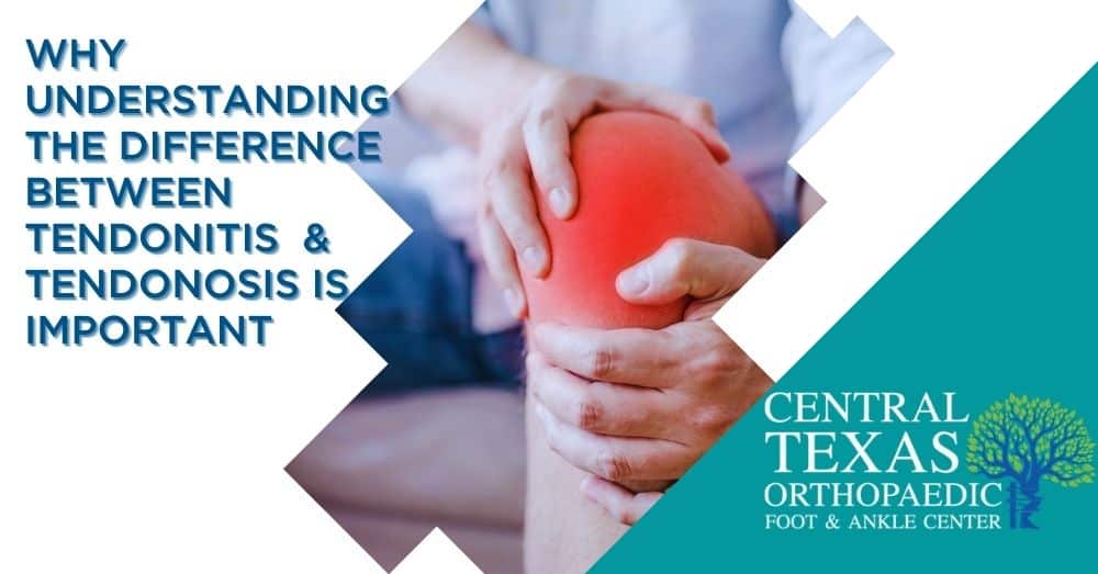 understanding the difference between tendonitis and tendonosis