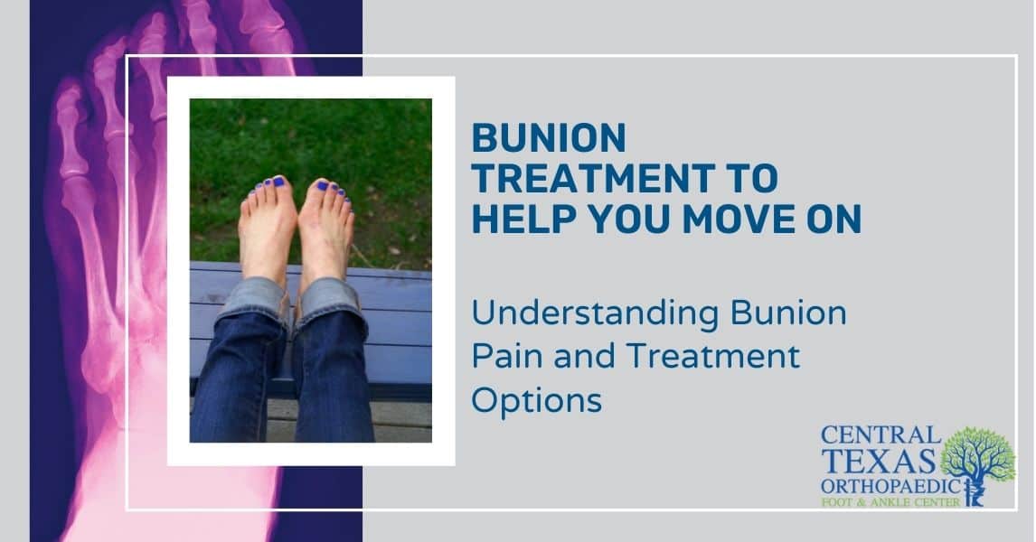 Bunion Pain Treatment Options