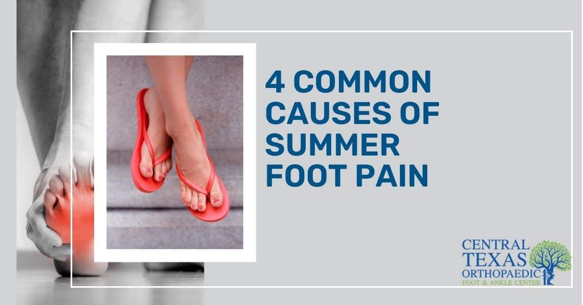 4 common causes of summer foot pain
