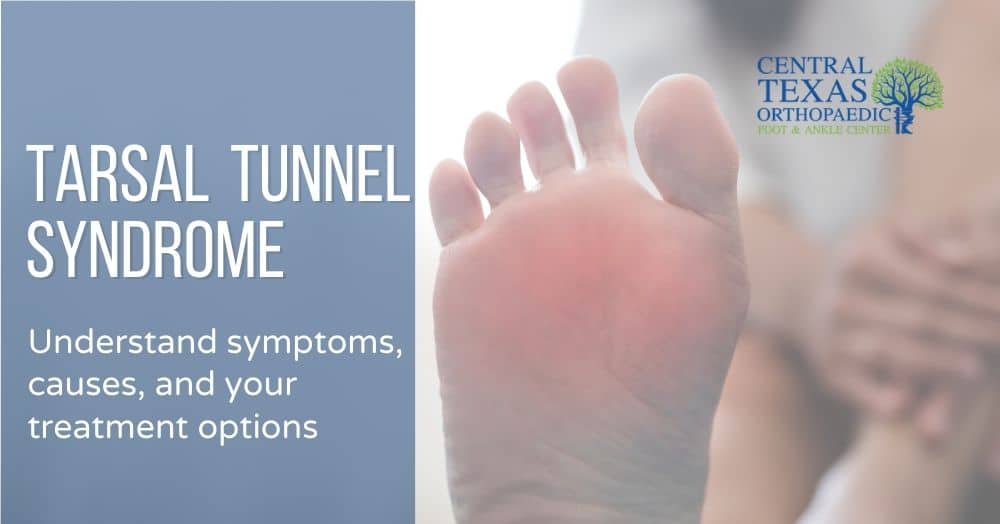 Understand the Symptoms and Causes of Tarsal Tunnel Syndrome