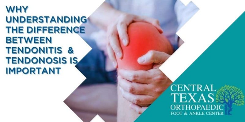 What is the Difference between Tendonitis and Tendonosis - Central